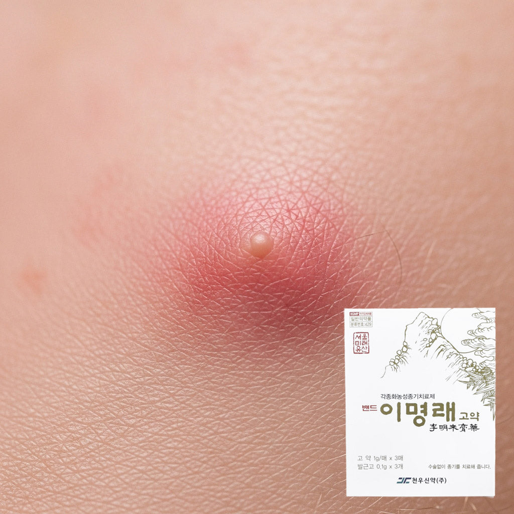 Lee Myeong-rae's ointment for boils, boils, and pus