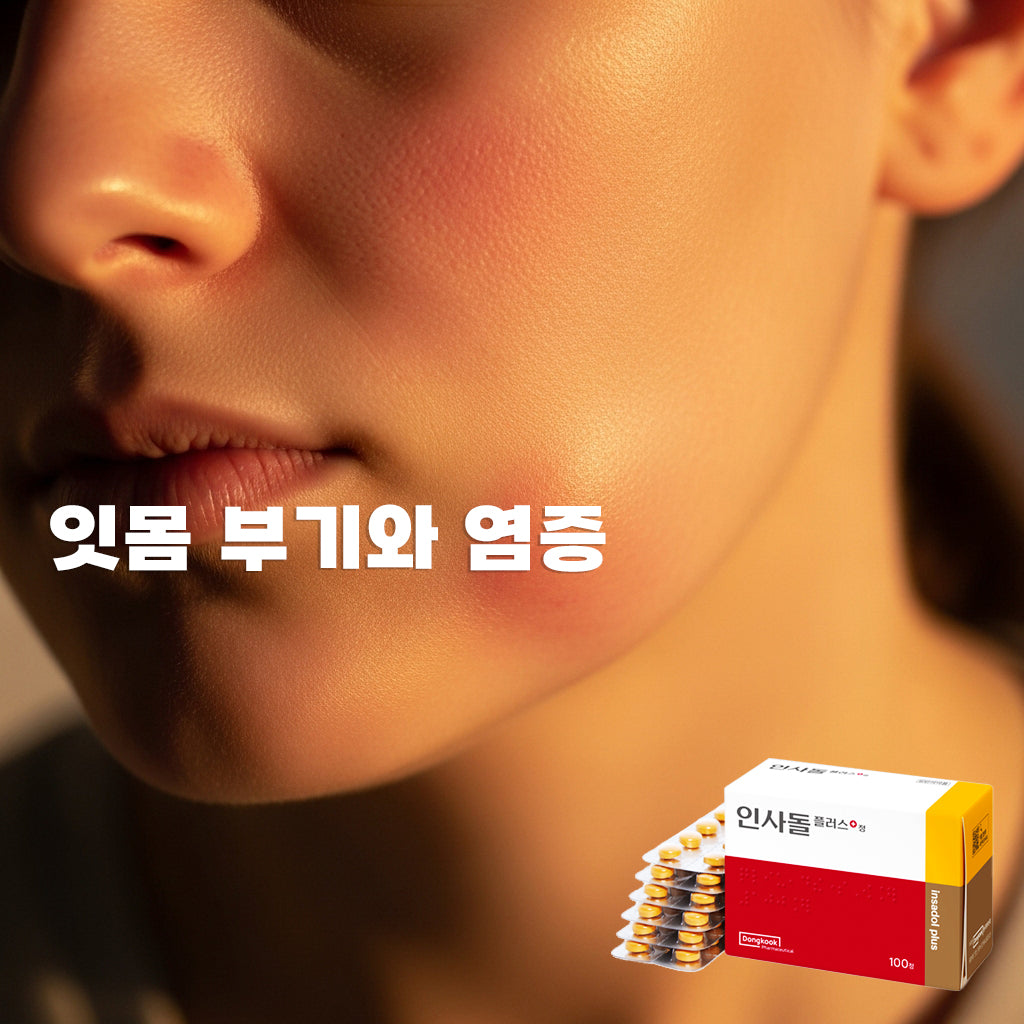 Insadol Plus 100 Tablets for the Treatment and Prevention of Gum Disease (Periodontitis)