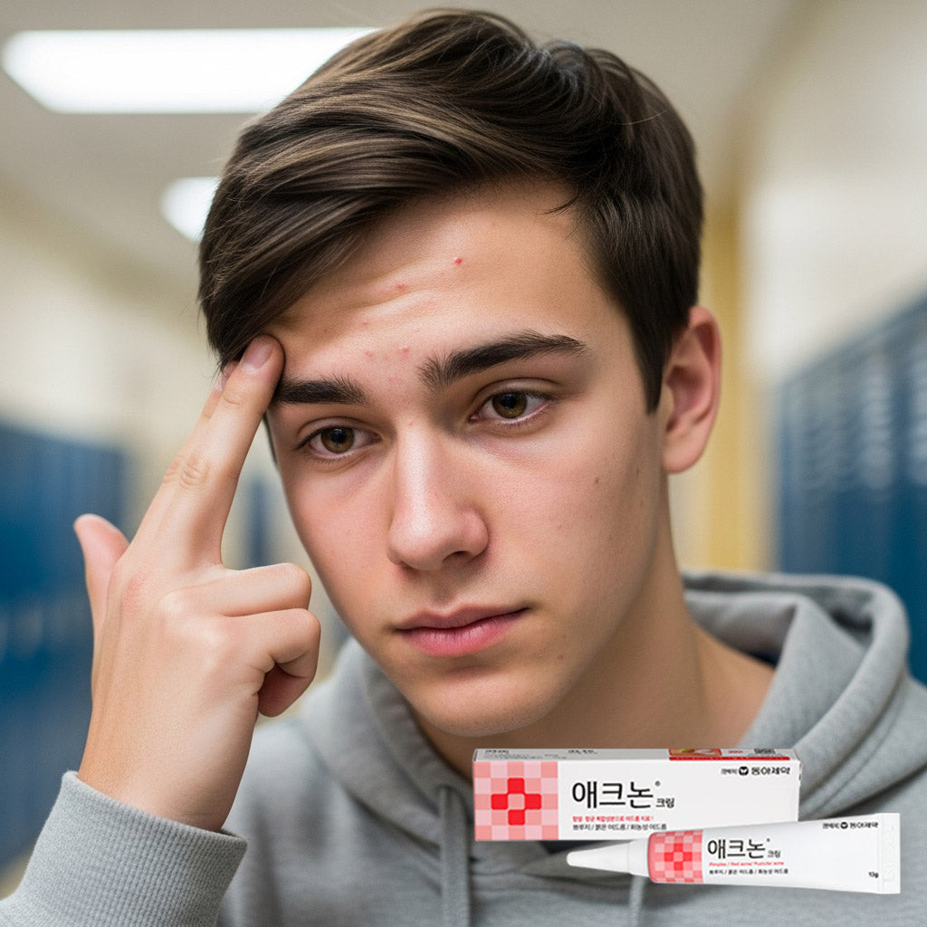 미국에서도 k-yak.com 에서 구매가가능한 애크논 크림