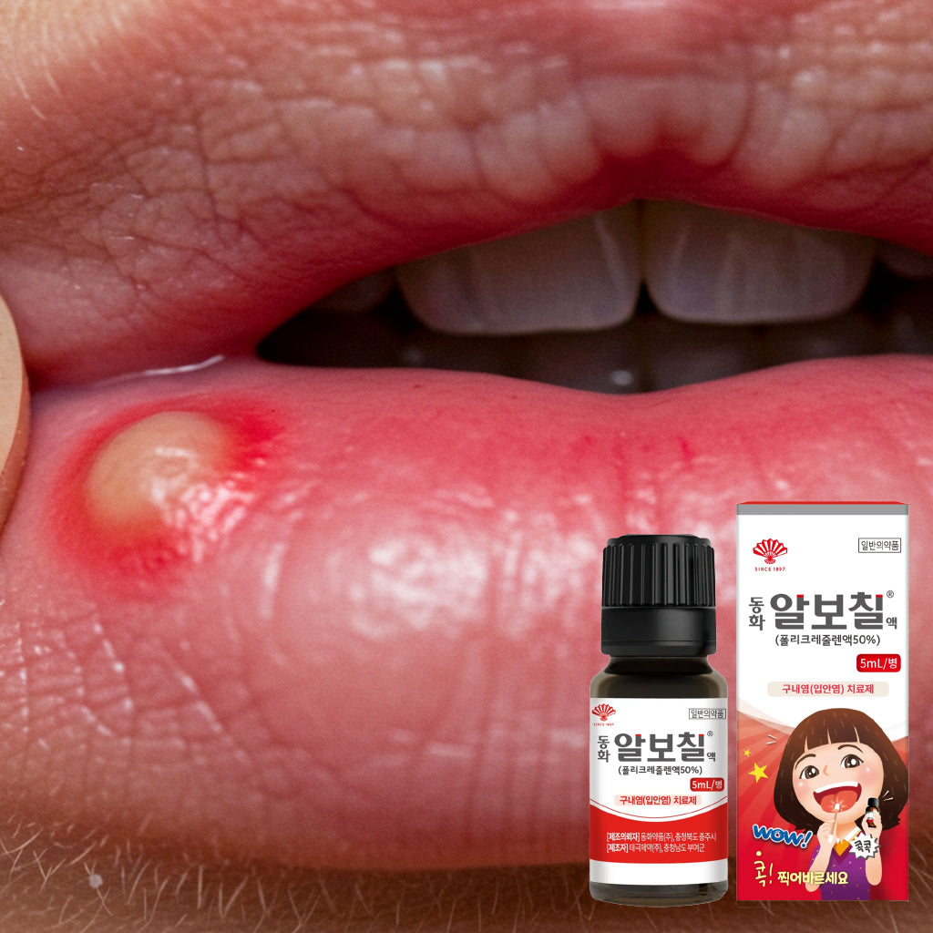 알보칠 경미한 입안 통증 완화를 위한 구강 세정 솔루션 – 5ml