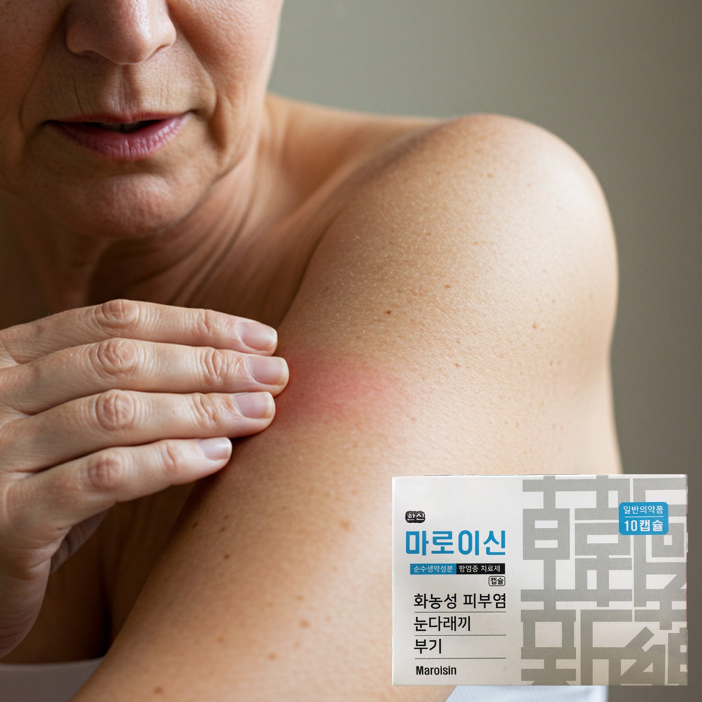 마로이신 10 캡슐 – 눈다래끼, 동반한 화농성 염증 및 발적, 부기, 통증 보조 관리 캡슐