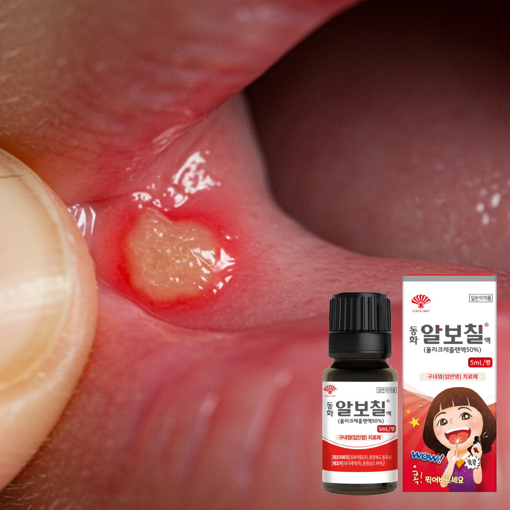 알보칠 경미한 입안 통증 완화를 위한 구강 세정 솔루션 – 5ml