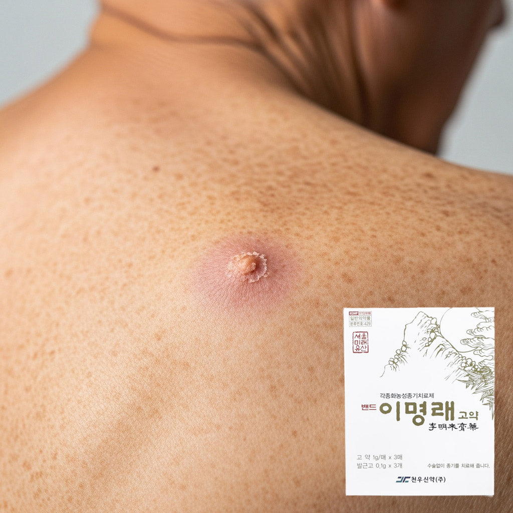 Lee Myeong-rae's ointment for boils, boils, and pus