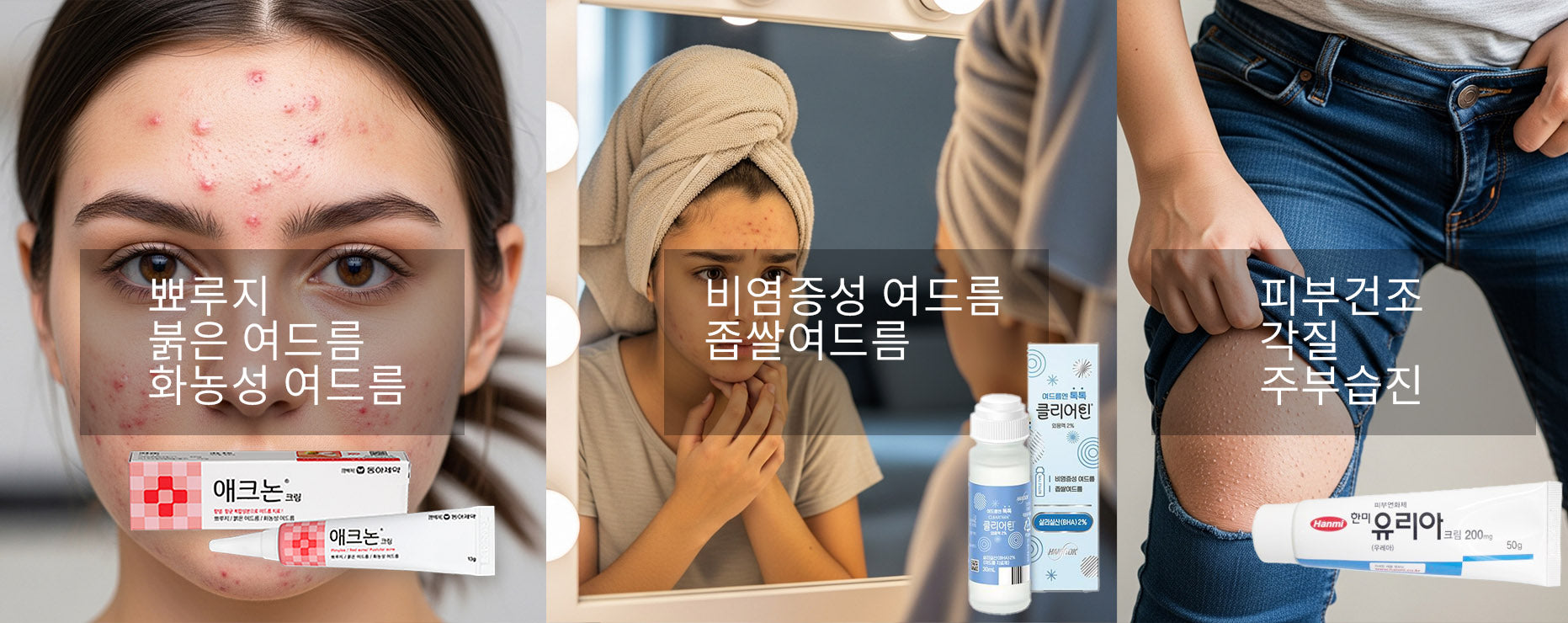 미국에서도 주문 애크논, 클리어틴, 유리아  K-YAK.COM